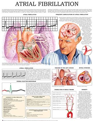 [c29bf] *Full% @Download~ Atrial fibrillation e-chart: Quick reference guide - HC-HealthComm ~ePub!