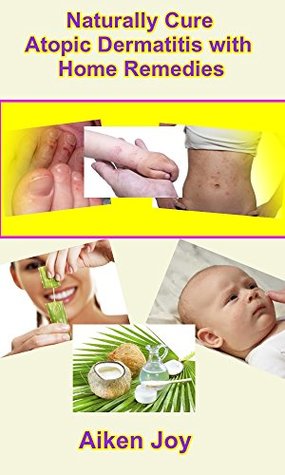 ea024] ^D.o.w.n.l.o.a.d! Naturally Cure Atopic Dermatitis with Home Remedies - Aiken Joy @ePub!