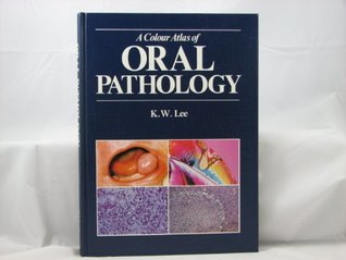 [ce0d7] #F.u.l.l.* @D.o.w.n.l.o.a.d* A Colour Atlas of Oral Pathology (Wolfe medical atlases) - K. W. Lee ^PDF^